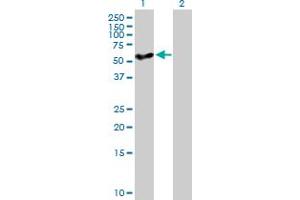 Western Blot analysis of CYP27A1 expression in transfected 293T cell line by CYP27A1 MaxPab polyclonal antibody. (CYP27A1 抗体  (AA 1-531))