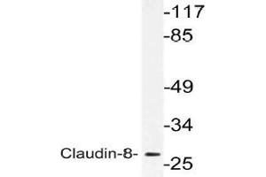 Western blot (WB) analysis of Claudin-8 antibody in extracts from Jurkat cells. (CLDN8 抗体)