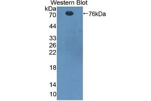 Detection of Recombinant CTTN, Rat using Polyclonal Antibody to Cortactin (CTTN) (Cortactin 抗体  (AA 1-509))