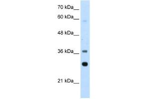 WB Suggested Anti-RPLP0 Antibody Titration:  2. (RPLP0 抗体  (Middle Region))