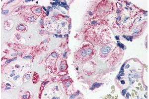 Human Placenta (formalin-fixed, paraffin-embedded) stained with C5AR1 antibody ABIN461687 followed by biotinylated goat anti-rabbit IgG secondary antibody ABIN481713, alkaline phosphatase-streptavidin and chromogen. (C5AR1 抗体  (Internal Region))