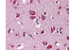 Anti-WNT7B antibody IHC of human brain, cortex.