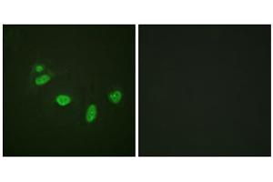 Immunofluorescence analysis of HeLa cells, using ETS1 (Phospho-Thr38) antibody. (ETS1 抗体  (pThr38))