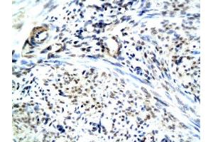 Formalin-fixed and paraffin embedded human uterine endomysium labeled with Anti-RAMP1 Polyclonal Antibody, Unconjugated (ABIN731438) followed by conjugation to the secondary antibody and DAB staining (RAMP1 抗体  (AA 118-148))