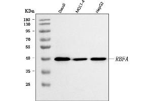 Western blot analysis of C18orf22/RBFA using anti-C18orf22/RBFA antibody (ABIN7600106).