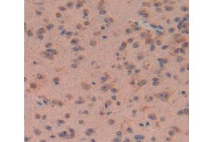 Used in DAB staining on fromalin fixed paraffin- embedded brain tissue (Calpain 5 抗体  (AA 26-343))