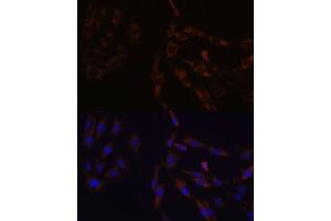 Immunofluorescence analysis of C6 cells using SUCLG2 Polyclonal Antibody  at dilution of 1:100 (40x lens). (SUCLG2 抗体  (AA 50-300))