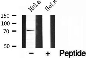 Western blot analysis of extracts of HeLa cells, using BRD7 antibody. (BRD7 抗体  (Internal Region))