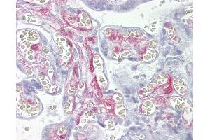 Anti-LGALS1 / Galectin 1 antibody IHC of human placenta. (LGALS1/Galectin 1 抗体  (AA 72-121))