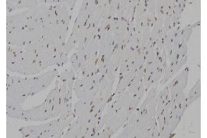ABIN6273462 at 1/100 staining Mouse heart tissue by IHC-P. (CENPN 抗体  (C-Term))