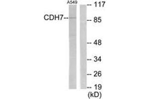 Western blot analysis of extracts from A549 cells, using CDH7 Antibody. (Cadherin 7 抗体  (AA 651-700))