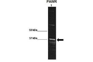 WB Suggested Anti-PAWR Antibody    Positive Control:  Lane 1: 30ug rat striatum homogenate  Primary Antibody Dilution :   1:1000  Secondary Antibody :  Anti rabbit-HRP   Secondry Antibody Dilution :   1:10,000  Submitted by:  Kristy Shimp, University of Florida (PAWR 抗体  (Middle Region))