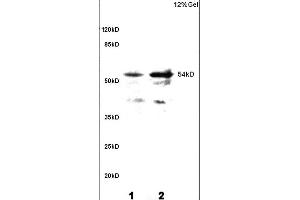 L1 and L2 rat brain lysates probed with Anti Phospho-CaMKII (Thr286) Polyclonal Antibody, Unconjugated (ABIN732473) at 1:200 overnight at 4 °C. (CAMK2B 抗体  (pThr287))