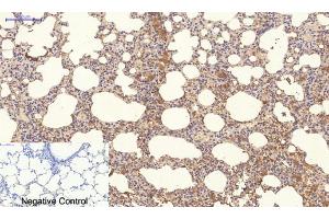 Immunohistochemistry (IHC) image for anti-Neighbor of BRCA1 Gene 1 (NBR1) antibody (ABIN5957970) (NBR1 抗体)