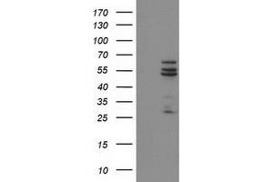 Western Blotting (WB) image for anti-Cytochrome P450, Family 2, Subfamily C, Polypeptide 9 (CYP2C9) antibody (ABIN1497725) (CYP2C9 抗体)