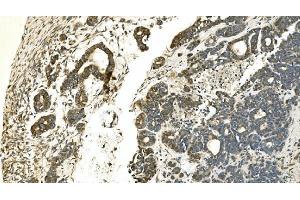 IHC analysis of Carbonic Anhydrase 13/CA13 using anti-Carbonic Anhydrase 13/CA13 antibody (ABIN7603164).