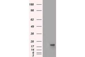 Image no. 2 for anti-Crystallin, alpha B (CRYAB) antibody (ABIN1497646) (CRYAB 抗体)