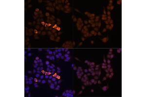 Immunofluorescence analysis of HeLa-Myc-CandHeLa cells using Rabbit anti Myc-Tag pAb-C-terminal (ABIN3020568 and ABIN3020569) at dilution of 1:100 (40x lens). (Myc Tag 抗体)