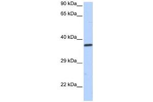 Western Blotting (WB) image for anti-Sex Comb On Midleg-Like 1 (SCML1) antibody (ABIN2458174) (SCML1 抗体)