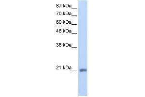 WB Suggested Anti-MIF4GD Antibody Titration:  1. (MIF4GD 抗体  (C-Term))