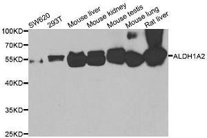ALDH1A2 抗体  (AA 1-180)