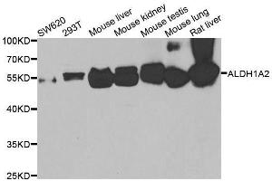 Western blot analysis of extracts of various cell lines, using ALDH1A2 antibody. (ALDH1A2 抗体  (AA 1-180))