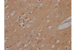 IHC image of ABIN7140049 diluted at 1:200 and staining in paraffin-embedded human brain tissue performed on a Leica BondTM system. (LPPR1 抗体  (AA 51-66))