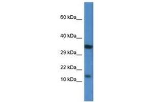 Image no. 1 for anti-Protein Kinase (CAMP-Dependent, Catalytic) Inhibitor beta (PKIB) (AA 40-89) antibody (ABIN6746525) (PKIB 抗体  (AA 40-89))