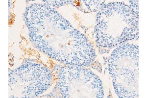 ABIN6267267 at 1/100 staining mouse testicular tissue sections by IHC-P. (EGFR 抗体  (pSer695))