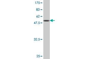 Western Blot detection against Immunogen (51. (TK1 抗体  (AA 1-234))