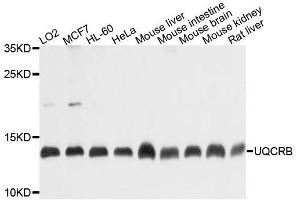 Western blot analysis of extracts of various cell lines, using UQCRB antibody. (UQCRB 抗体  (AA 1-111))