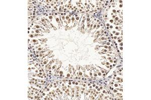 Immunohistochemistry of paraffin embedded rat testis using CDY1 (ABIN7073493) at dilution of 1:400 (300x lens) (CDY1 抗体)