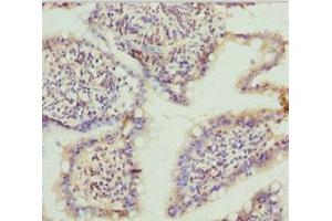 Immunohistochemistry of paraffin-embedded human small intestine tissue using ABIN7171763 at dilution of 1:100 (TNS3 抗体  (AA 1-240))