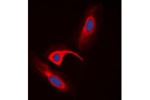 Immunofluorescent analysis of CBR1 staining in HeLa cells. (CBR1 抗体  (Center))