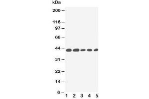 Western blot testing of IL-2 Receptor antibody and Lane 1:  PANC;  2: HeLa;  3: Jurkat;  4: Raji;  5: CEM cell lysate.