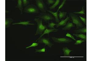 Immunofluorescence of purified MaxPab antibody to CTDSP2 on HeLa cell. (CTDSP2 抗体  (AA 1-271))