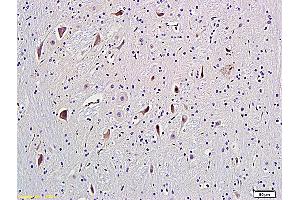 Formalin-fixed and paraffin embedded rat brain labeled with Anti-GRM5/mGluR5 Polyclonal Antibody, Unconjugated (ABIN673914) followed by conjugation to the secondary antibody and DAB staining (Metabotropic Glutamate Receptor 5 抗体  (AA 201-300))