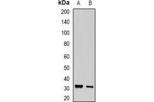 Western blot analysis of PA28 gamma expression in MCF7 (A), PC12 (B) whole cell lysates. (PSME3 抗体)