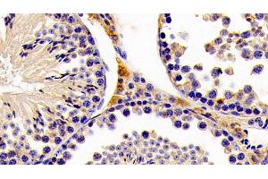 Detection of HMGCS2 in Mouse Testis Tissue using Polyclonal Antibody to Hydroxymethylglutaryl Coenzyme A Synthase 2, Mitochondrial (HMGCS2) (HMGCS2 抗体  (AA 1-167))