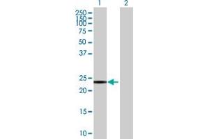 Western Blot analysis of SNAP23 expression in transfected 293T cell line by SNAP23 MaxPab polyclonal antibody. (SNAP23 抗体  (AA 1-211))