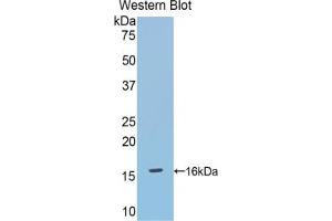 Western blot analysis of the recombinant protein. (DBR1 抗体  (AA 133-241))