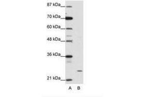 Image no. 1 for anti-Zinc Finger Protein 253 (ZNF253) (C-Term) antibody (ABIN202147) (ZNF253 抗体  (C-Term))