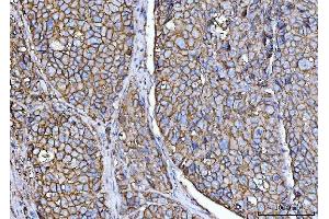 IHC analysis of CD147/Emmprin using anti-CD147/Emmprin antibody (ABIN7599997). (CD147 抗体  (AA 138-323))