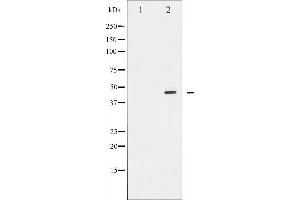 Western blot analysis of E2F1 expression in Etoposide treated HeLa whole cell lysates,The lane on the left is treated with the antigen-specific peptide. (E2F1 抗体  (C-Term))