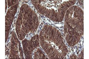 Image no. 5 for anti-Von Hippel-Lindau Tumor Suppressor, E3 Ubiquitin Protein Ligase (VHL) antibody (ABIN1501712)