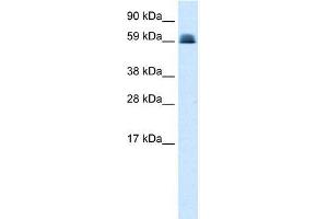 Human Lung; WB Suggested Anti-ZNF499 Antibody Titration: 0. (ZBTB45 抗体  (Middle Region))