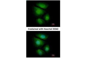 ICC/IF Image Immunofluorescence analysis of paraformaldehyde-fixed MCF-7, using RNF13, antibody at 1:500 dilution. (RNF13 抗体  (C-Term))