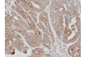 IHC-P Image Immunohistochemical analysis of paraffin-embedded N87 xenograft, using USP15, antibody at 1:100 dilution. (USP15 抗体  (C-Term))