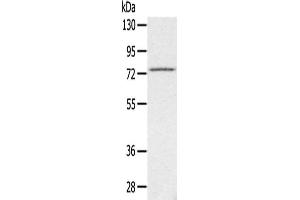 Gel: 6 % SDS-PAGE,Lysate: 40 μg,Primary antibody: ABIN7192448(SLC26A5 Antibody) at dilution 1/200 dilution,Secondary antibody: Goat anti rabbit IgG at 1/8000 dilution,Exposure time: 3 minutes (SLC26A5 抗体)