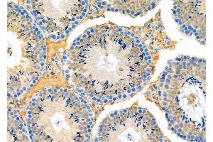 ABIN6263228 and ABIN6273139 at 1/100 staining Mouse testis tissue by IHC-P. (MEST 抗体  (C-Term))